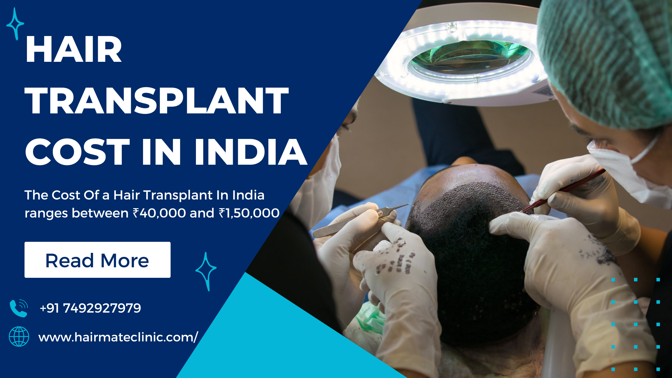 Hair Transpllant Cost in India
